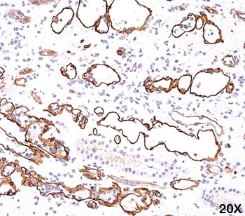 Complement C4d Antibody - C4d antibody Complement 4d immunohistochemistry 2.  This image was taken for the unmodified form of this product. Other forms have not been tested.