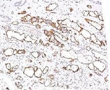 Complement C4d Antibody - IHC testing of FFPE human kidney transplant tissue stained with C4d antibody (CPT4d-1).  This image was taken for the unmodified form of this product. Other forms have not been tested.