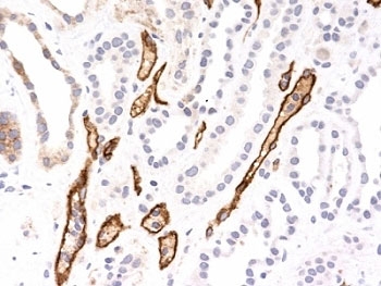 Complement C4d Antibody - Formalin-fixed, paraffin-embedded human kidney transplant stained with Complement 4d antibody (SPM545).  This image was taken for the unmodified form of this product. Other forms have not been tested.