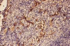 Complement C5 Antibody - Complement C5 antibody. IHC(P): Mouse Spleen Tissue.