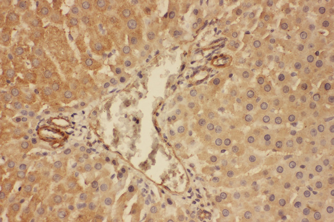 Complement C5 Antibody - Complement C5 antibody. IHC(P): Rat Liver Tissue.