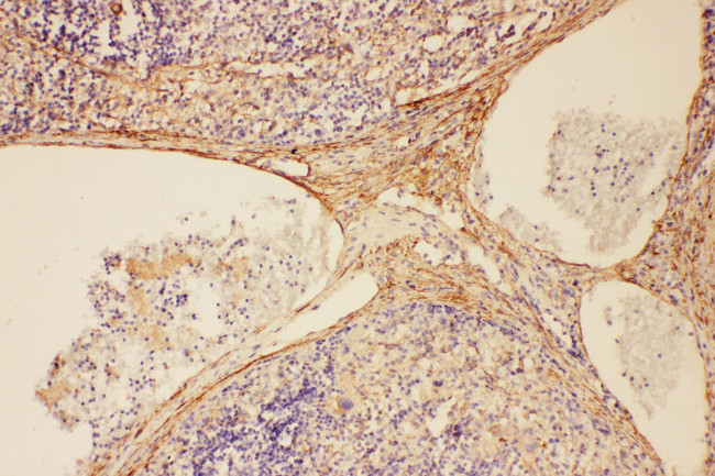 Complement C5 Antibody - Complement C5 antibody. IHC(P): Rat Spleen Tissue.