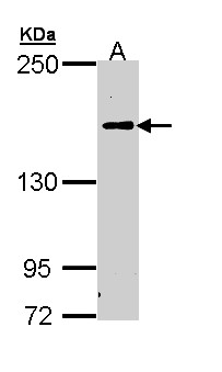 Complement C5 Antibody - Sample (30 ug of whole cell lysate). A: H1299. 5% SDS PAGE. Complement C5 antibody diluted at 1:1000.