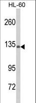 Complement C5 Antibody - Western blot of C5 Antibody in HL-60 cell line lysates (35 ug/lane). C5 (arrow) was detected using the purified antibody.(2 ug/ml)