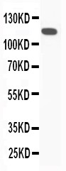Complement C5 Antibody - C5/C5a antibody All Western blot. All lanes: Anti-C5a at 0.5 ug/ml. WB: Rat Liver Tissue Lysate at 40 ug. Predicted band size: 115 kD. Observed band size: 115 kD.