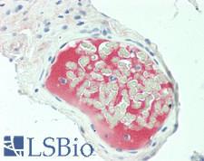 Complement C5 Antibody - Human Small Intestine, Vessel: Formalin-Fixed, Paraffin-Embedded (FFPE)