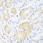 Complement C5 Antibody - Immunohistochemistry of paraffin-embedded human stomach using C5 antibody at dilution of 1:100 (40x lens).