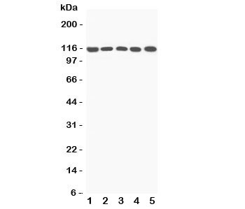 Complement C5a Antibody - Western blot testing of C5a antibody and Lane 1: rat liver; 2: mouse liver; 3: (m) NIH3T3; 4: (m) HEPA; 5: (r) PC12 lysate; Predicted/Observed size: 115KD