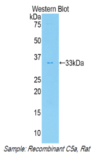 Complement C5a Antibody - Western blot of recombinant Complement C5a.  This image was taken for the unconjugated form of this product. Other forms have not been tested.