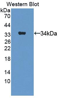 Complement C5a Antibody - Western blot of Complement C5a antibody.