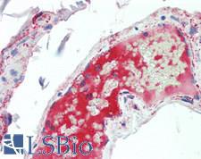 Complement C5a Antibody - Human Small Intestine, Vessel: Formalin-Fixed, Paraffin-Embedded (FFPE)
