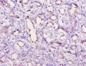 Complement C5a Antibody - Immunohistochemistry of paraffin-embedded human kidney tissue using C5 Antibody at dilution of 1:10