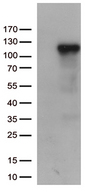 Complement C6 Antibody - HEK293T cells were transfected with the pCMV6-ENTRY control. (Left lane) or pCMV6-ENTRY C6. (Right lane) cDNA for 48 hrs and lysed. Equivalent amounts of cell lysates. (5 ug per lane) were separated by SDS-PAGE and immunoblotted with anti-C6. (1:500)