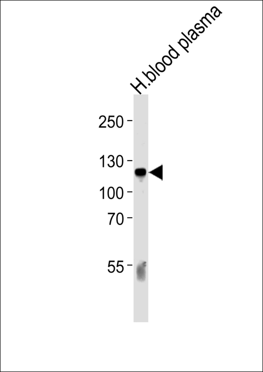 Complement C6 Antibody - Western blot of lysate from human blood plasma tissue lysate, using C6 Antibody. Antibody was diluted at 1:1000 at each lane. A goat anti-rabbit IgG H&L (HRP) at 1:5000 dilution was used as the secondary antibody. Lysate at 35ug per lane.