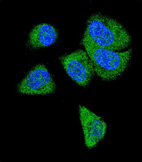 Complement C6 Antibody - Confocal immunofluorescence of C6 Antibody with MDA-MB231 cell followed by Alexa Fluor 488-conjugated goat anti-rabbit lgG (green). DAPI was used to stain the cell nuclear (blue).