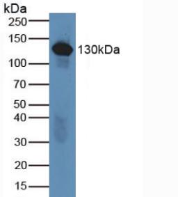 Complement C6 Antibody - Western Blot; Sample: Human Serum.