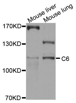 Complement C6 Antibody - Western blot analysis of extracts of various cell lines, using C6 antibody at 1:1000 dilution. The secondary antibody used was an HRP Goat Anti-Rabbit IgG (H+L) at 1:10000 dilution. Lysates were loaded 25ug per lane and 3% nonfat dry milk in TBST was used for blocking. An ECL Kit was used for detection and the exposure time was 10s.