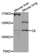 Complement C6 Antibody - Western blot analysis of extracts of various cell lines, using C6 antibody at 1:1000 dilution. The secondary antibody used was an HRP Goat Anti-Rabbit IgG (H+L) at 1:10000 dilution. Lysates were loaded 25ug per lane and 3% nonfat dry milk in TBST was used for blocking. An ECL Kit was used for detection and the exposure time was 10s.