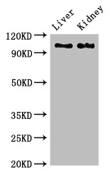 Complement C6 Antibody - Positive WB detected in:Rat liver tissue,Mouse kidney tissue;All lanes:C6 antibody at 2.7?g/ml;Secondary;Goat polyclonal to rabbit IgG at 1/50000 dilution;Predicted band size: 105 KDa;Observed band size: 105 KDa;