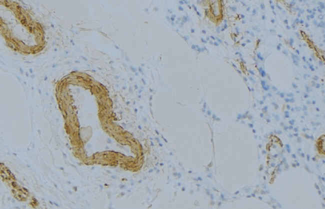 Complement C6 Antibody - 1:100 staining human uterus tissue by IHC-P. The sample was formaldehyde fixed and a heat mediated antigen retrieval step in citrate buffer was performed. The sample was then blocked and incubated with the antibody for 1.5 hours at 22°C. An HRP conjugated goat anti-rabbit antibody was used as the secondary.