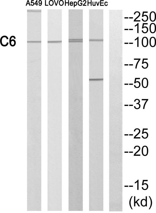 Complement C6 Antibody - Western blot analysis of extracts from A549 cells, LOVO cells and HepG2 cells, using C6 antibody.
