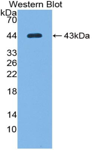 Complement C7 Antibody - Western blot of recombinant Complement C7.
