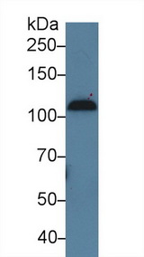 Complement C7 Antibody - Western Blot; Sample: Human Serum; Primary Ab: 5µg/ml Rabbit Anti-Human C7 Antibody Second Ab: 0.2µg/mL HRP-Linked Caprine Anti-Rabbit IgG Polyclonal Antibody