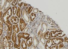 Complement C7 Antibody - 1:100 staining mouse kidney tissue by IHC-P. The sample was formaldehyde fixed and a heat mediated antigen retrieval step in citrate buffer was performed. The sample was then blocked and incubated with the antibody for 1.5 hours at 22°C. An HRP conjugated goat anti-rabbit antibody was used as the secondary.