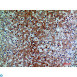 Complement C7 Antibody - Immunohistochemistry (IHC) analysis of paraffin-embedded Human Liver, antibody was diluted at 1:200.