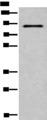Complement C7 Antibody - Western blot analysis of HUVEC cell lysate  using C7 Polyclonal Antibody at dilution of 1:800