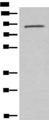 Complement C7 Antibody - Western blot analysis of Mouse lung tissue lysate  using C7 Polyclonal Antibody at dilution of 1:800