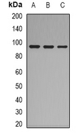 Complement C7 Antibody - Western blot analysis of Complement C7 expression in HepG2 (A); K562 (B); mouse lung (C) whole cell lysates.