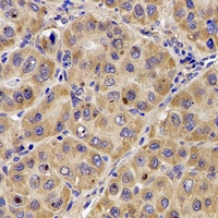 Complement C7 Antibody - Immunohistochemical analysis of Complement C7 staining in human liver formalin fixed paraffin embedded tissue section. The section was pre-treated using heat mediated antigen retrieval with sodium citrate buffer (pH 6.0). The section was then incubated with the antibody at room temperature and detected using an HRP polymer system. DAB was used as the chromogen. The section was then counterstained with hematoxylin and mounted with DPX.