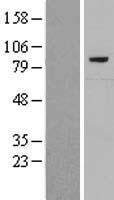 Complement C7 Protein - Western validation with an anti-DDK antibody * L: Control HEK293 lysate R: Over-expression lysate