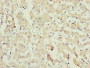 Complement C8A Antibody - Immunohistochemistry of paraffin-embedded human liver tissue at dilution of 1:100