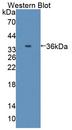 Complement C8A Antibody - Western Blot; Sample: Recombinant protein.