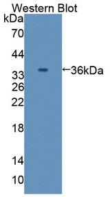 Complement C8A Antibody - Western Blot; Sample: Recombinant protein.