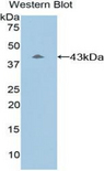 Complement C8b Antibody - Western blot of recombinant Complement C8B.  This image was taken for the unconjugated form of this product. Other forms have not been tested.