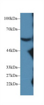 Complement C8b Antibody - Western Blot; Sample: Mouse Serum; Primary Ab: 2µg/ml Rabbit Anti-Mouse C8b Antibody Second Ab: 0.2µg/mL HRP-Linked Caprine Anti-Rabbit IgG Polyclonal Antibody