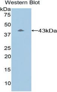Complement C8b Antibody - Western blot of recombinant Complement C8B.  This image was taken for the unconjugated form of this product. Other forms have not been tested.