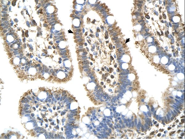 Complement C8b Antibody - C8B antibody C8B(complement component 8, beta polypeptide) Antibody was used in IHC to stain formalin-fixed, paraffin-embedded human intestine.  This image was taken for the unconjugated form of this product. Other forms have not been tested.