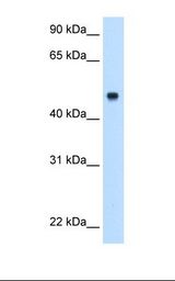 Complement C8b Antibody - Fetal liver cell lysate. Antibody concentration: 0.5 ug/ml. Gel concentration: 12%.  This image was taken for the unconjugated form of this product. Other forms have not been tested.