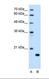 Complement C8b Antibody - Lane A: Marker. Lane B: HepG2 cell lysate. Antibody concentration: 0.25 ug/ml. Gel concentration: 12%.  This image was taken for the unconjugated form of this product. Other forms have not been tested.