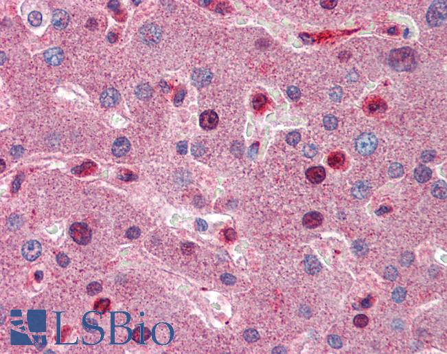 Complement C8b Antibody - Anti-C8B antibody IHC of human liver. Immunohistochemistry of formalin-fixed, paraffin-embedded tissue after heat-induced antigen retrieval. Antibody concentration 5 ug/ml.  This image was taken for the unconjugated form of this product. Other forms have not been tested.