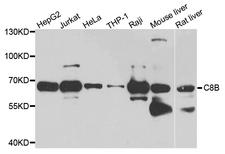Complement C8b Antibody - Western blot analysis of extract of various cells.