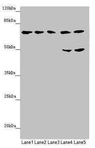 Complement C8b Antibody - Western blot All Lanes:C8B antibody at 1.28 ug/ml Lane 1: Hela whole cell lysate Lane 2: Jurkat whole cell lysate Lane 3: HepG-2 whole cell lysate Lane 4: Raji whole cell lysate Lane 5: Mouse liver tissue Secondary Goat polyclonal to rabbit IgG at 1/10000 dilution Predicted band size: 67 kDa Observed band size: 67,50 kDa