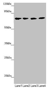 Complement C8b Antibody - Western blot All lanes: C8B antibody at 1.28µg/ml Lane 1: Hela whole cell lysate Lane 2: Jurkat whole cell lysate Lane 3: Raji whole cell lysate Lane 4: Mouse liver tissue Secondary Goat polyclonal to rabbit IgG at 1/10000 dilution Predicted band size: 67 kDa Observed band size: 67 kDa