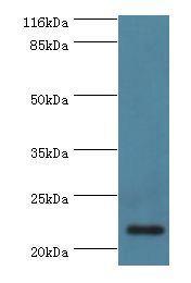 Complement C8g Antibody - Western blot. All lanes: Complement component C8 gamma chain antibody at 2 ug/ml+human serum. Secondary antibody: goat polyclonal to rabbit at 1:10000 dilution. Predicted band size: 22 kDa. Observed band size: 22 kDa.  This image was taken for the unconjugated form of this product. Other forms have not been tested.