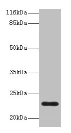 Complement C8g Antibody - Western blot All lanes: Complement component C8 gamma chain antibody at 2µg/ml + human serumSecondary Secondary Goat polyclonal to rabbit IgG at 1/10000 dilution Predicted band size: 22 kDa Observed band size: 22 kDa