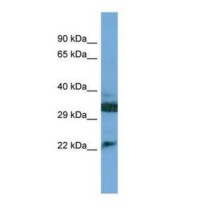 Complement C8g Antibody - Western blot of Human Jurkat. C8G antibody dilution 1.0 ug/ml.  This image was taken for the unconjugated form of this product. Other forms have not been tested.